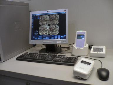 【写真3】 オリンパスのカプセル内視鏡解析画面，右手前がリアルタイムビューワ，右奥は患者の腰に付ける画像記録装置